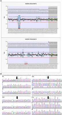 Whole Exome Sequencing Aids the Diagnosis of Fetal Skeletal Dysplasia